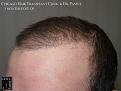 Click image for larger version

Name:	Slide22.JPG
Views:	587
Size:	58.4 KB
ID:	479763