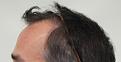 Click image for larger version

Name:	Before (2) (1).jpg
Views:	351
Size:	86.4 KB
ID:	479824
