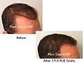 Click image for larger version

Name:	Hair Transplant Slides copy1111.004.jpg
Views:	349
Size:	12.6 KB
ID:	479846
