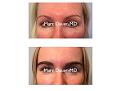 Click image for larger version

Name:	Hair Transplant Slides copy55555.003.jpg
Views:	287
Size:	9.8 KB
ID:	479905