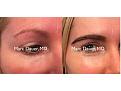 Click image for larger version

Name:	Hair Transplant Slides copy55555.002.jpg
Views:	297
Size:	12.0 KB
ID:	479906