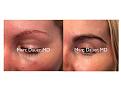 Click image for larger version

Name:	Hair Transplant Slides copy55555.001.jpg
Views:	299
Size:	11.5 KB
ID:	479907