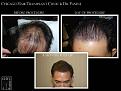 Click image for larger version

Name:	Slide2.JPG
Views:	274
Size:	69.5 KB
ID:	479955