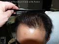 Click image for larger version

Name:	Slide8.JPG
Views:	246
Size:	78.9 KB
ID:	479961