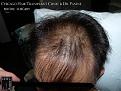 Click image for larger version

Name:	Slide9.jpg
Views:	265
Size:	93.7 KB
ID:	479962