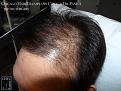 Click image for larger version

Name:	Slide10.JPG
Views:	243
Size:	93.3 KB
ID:	479963
