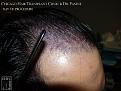 Click image for larger version

Name:	Slide14.JPG
Views:	255
Size:	86.0 KB
ID:	479967