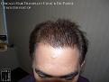 Click image for larger version

Name:	Slide16.JPG
Views:	252
Size:	63.4 KB
ID:	479969