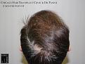 Click image for larger version

Name:	Slide22.JPG
Views:	271
Size:	68.7 KB
ID:	479975