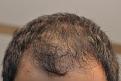 Click image for larger version

Name:	Hairline.jpg
Views:	1011
Size:	75.6 KB
ID:	480091