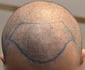 Click image for larger version

Name:	Shaved.jpg
Views:	897
Size:	73.2 KB
ID:	480094