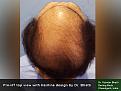 Click image for larger version

Name:	Pre-HT Pics-02.jpg
Views:	771
Size:	84.7 KB
ID:	480190