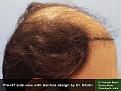 Click image for larger version

Name:	Pre-HT Pics-03.jpg
Views:	631
Size:	91.4 KB
ID:	480191