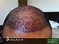 Click image for larger version

Name:	3rd day.jpg
Views:	771
Size:	87.2 KB
ID:	480194