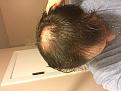 Click image for larger version

Name:	IMG_2248.jpg
Views:	403
Size:	91.4 KB
ID:	481539
