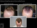 Click image for larger version

Name:	Slide5.JPG
Views:	381
Size:	63.0 KB
ID:	481568
