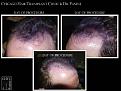 Click image for larger version

Name:	Slide6.JPG
Views:	400
Size:	74.1 KB
ID:	481569