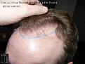 Click image for larger version

Name:	Slide9.JPG
Views:	383
Size:	80.2 KB
ID:	481572