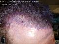 Click image for larger version

Name:	Slide12.jpg
Views:	370
Size:	93.9 KB
ID:	481575