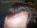 Click image for larger version

Name:	Slide14.JPG
Views:	405
Size:	92.5 KB
ID:	481577