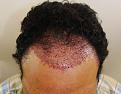 Click image for larger version

Name:	jg imm post chin down.jpg
Views:	388
Size:	90.5 KB
ID:	481680