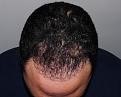 Click image for larger version

Name:	jg 10 mos post chin down.jpg
Views:	345
Size:	94.6 KB
ID:	481681