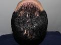 Click image for larger version

Name:	jg 10 mos post chin up.jpg
Views:	356
Size:	95.6 KB
ID:	481683
