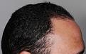 Click image for larger version

Name:	jg 10 mos post R profile.jpg
Views:	381
Size:	97.0 KB
ID:	481685