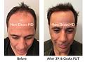 Click image for larger version

Name:	Hair Transplant Slides copy01.008.jpg
Views:	295
Size:	16.2 KB
ID:	481689
