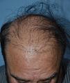 Click image for larger version

Name:	Darling Buds Hair transplant clinic India (1).jpg
Views:	210
Size:	93.8 KB
ID:	481730