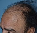 Click image for larger version

Name:	Darling Buds Hair transplant clinic India (2).jpg
Views:	255
Size:	92.8 KB
ID:	481732