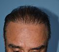 Click image for larger version

Name:	Darling Buds Hair transplant clinic India (6).jpg
Views:	314
Size:	91.3 KB
ID:	481735