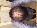Click image for larger version

Name:	IMG_3017.jpg
Views:	381
Size:	37.4 KB
ID:	481784