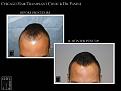 Click image for larger version

Name:	Slide1.JPG
Views:	423
Size:	49.7 KB
ID:	481849