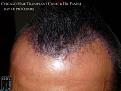 Click image for larger version

Name:	Slide11.JPG
Views:	405
Size:	84.3 KB
ID:	481859