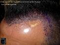 Click image for larger version

Name:	Slide12.jpg
Views:	419
Size:	93.9 KB
ID:	481860