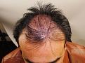 Click image for larger version

Name:	jm imm post chin down (2).jpg
Views:	249
Size:	92.6 KB
ID:	481887