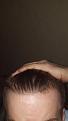 Click image for larger version

Name:	Hairline 2.jpg
Views:	15467
Size:	4.2 KB
ID:	481904