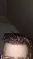 Click image for larger version

Name:	Hairline.jpg
Views:	4917
Size:	4.3 KB
ID:	481905