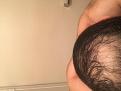 Click image for larger version

Name:	IMG_0956.jpg
Views:	280
Size:	86.9 KB
ID:	482031