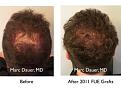 Click image for larger version

Name:	2011 FUE.005.jpg
Views:	311
Size:	16.3 KB
ID:	482062