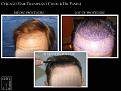 Click image for larger version

Name:	Slide1.JPG
Views:	534
Size:	71.9 KB
ID:	482068