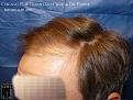 Click image for larger version

Name:	Slide7.JPG
Views:	526
Size:	90.9 KB
ID:	482074