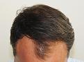 Click image for larger version

Name:	ar before chin down.jpg
Views:	382
Size:	86.1 KB
ID:	482085
