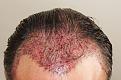 Click image for larger version

Name:	ar imm post chin down.jpg
Views:	402
Size:	94.2 KB
ID:	482086