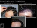 Click image for larger version

Name:	Slide4.JPG
Views:	305
Size:	70.5 KB
ID:	482210