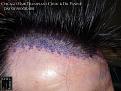 Click image for larger version

Name:	Slide14.jpg
Views:	302
Size:	93.7 KB
ID:	482220