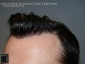 Click image for larger version

Name:	Slide18.JPG
Views:	308
Size:	65.8 KB
ID:	482224
