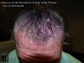 Click image for larger version

Name:	Slide10.JPG
Views:	271
Size:	79.6 KB
ID:	482545