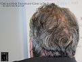 Click image for larger version

Name:	Slide22.JPG
Views:	265
Size:	96.8 KB
ID:	482557
